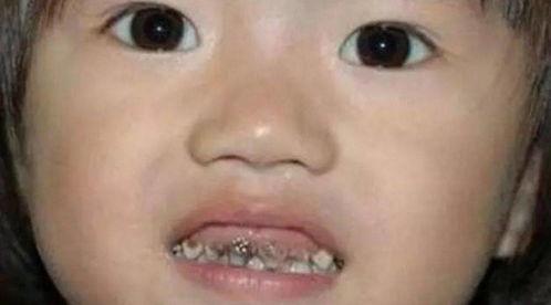 小白牙吃瓜视频,揭秘娱乐圈幕后故事